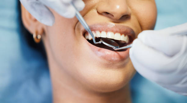 Best Emergency Root Canal Treatment in Orangeville, UT
